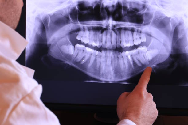Best Emergency Dentist for Special Needs Patients in El Macero, CA